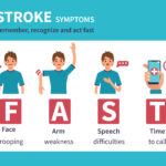 Act FAST: Recognize Stroke Symptoms Quickly