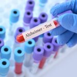 An FDA-Approved Blood Test for Alzheimer’s Disease