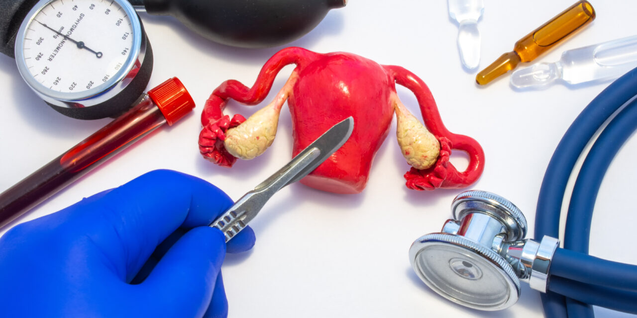 Can a Hysterectomy Prevent Cancer?