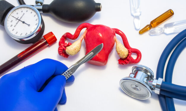 Can a Hysterectomy Prevent Cancer?