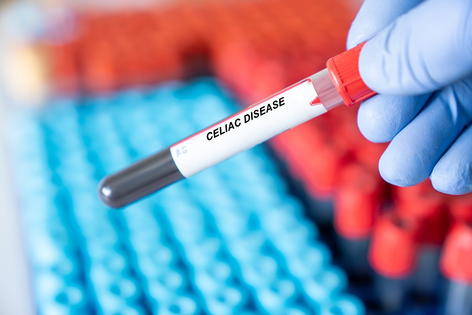 Celiac Disease: New Treatments and New Hope 