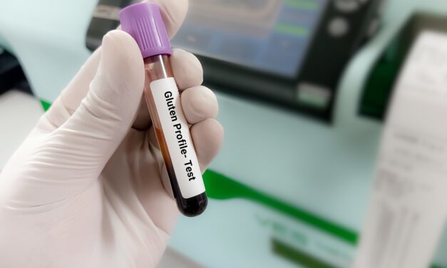 Celiac Disease: Recent Research and Clinical Progress