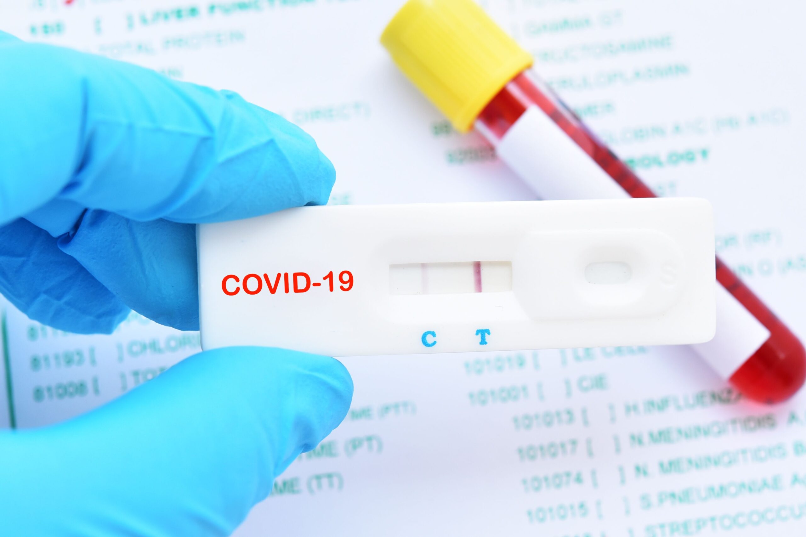 FDA-Approved Rapid COVID Testing
