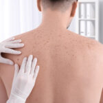 Have You Scheduled Your Annual Skin Check?