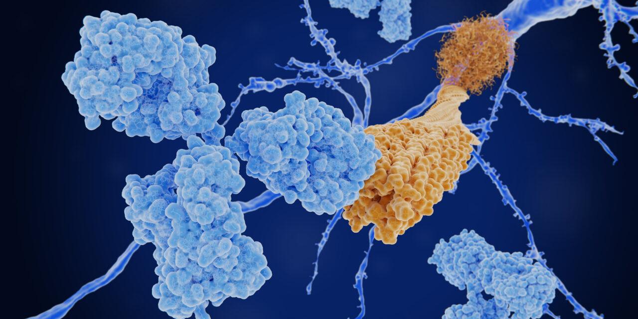 Immunotherapy Treatment for Alzheimer’s Disease