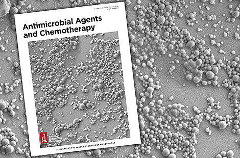 Study: UB Researchers Develop New Inhalable Treatment for TB