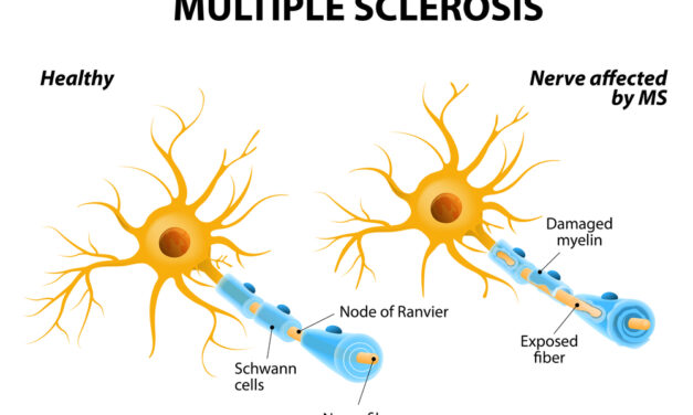 Medical 411: Multiple Sclerosis