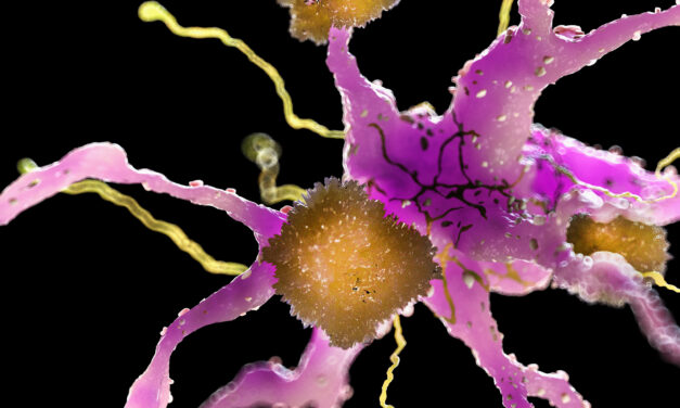 New Alzheimer’s Drug Shows Promise