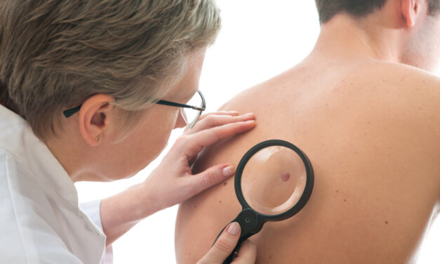 Not All Skin Cancers Are Melanomas