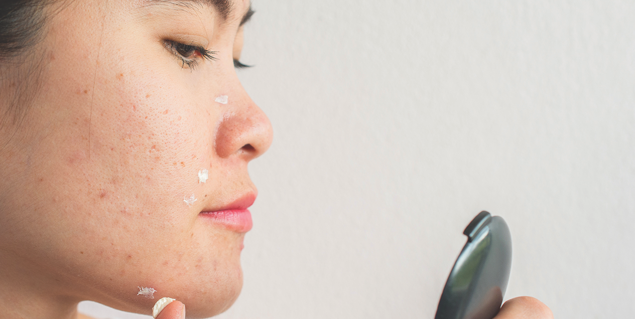 Remedies for Common Skin Issues