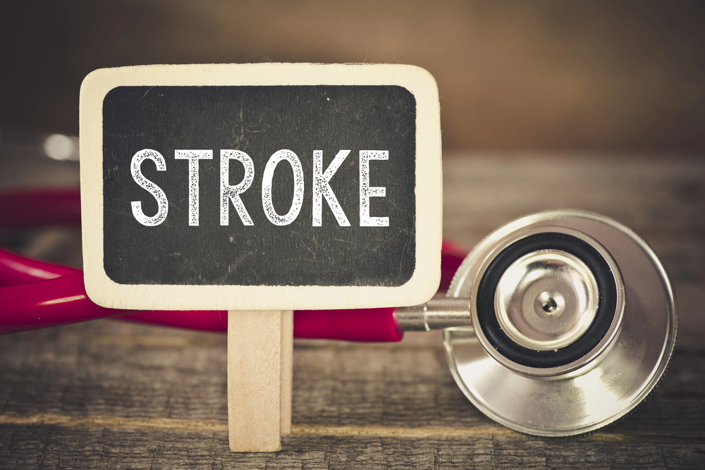 Stroke: What You Need to Know