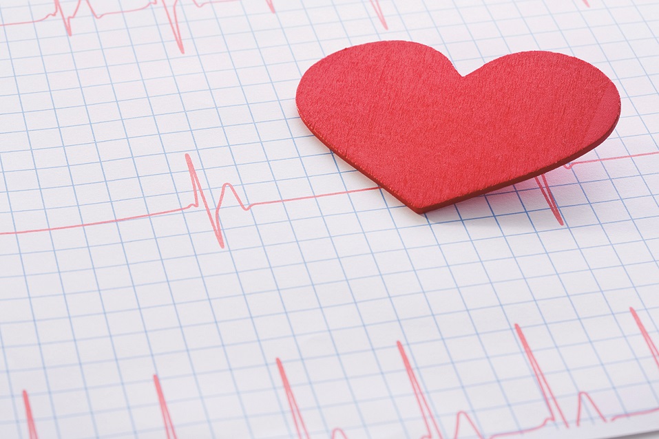 What Causes Atrial Fibrillation?