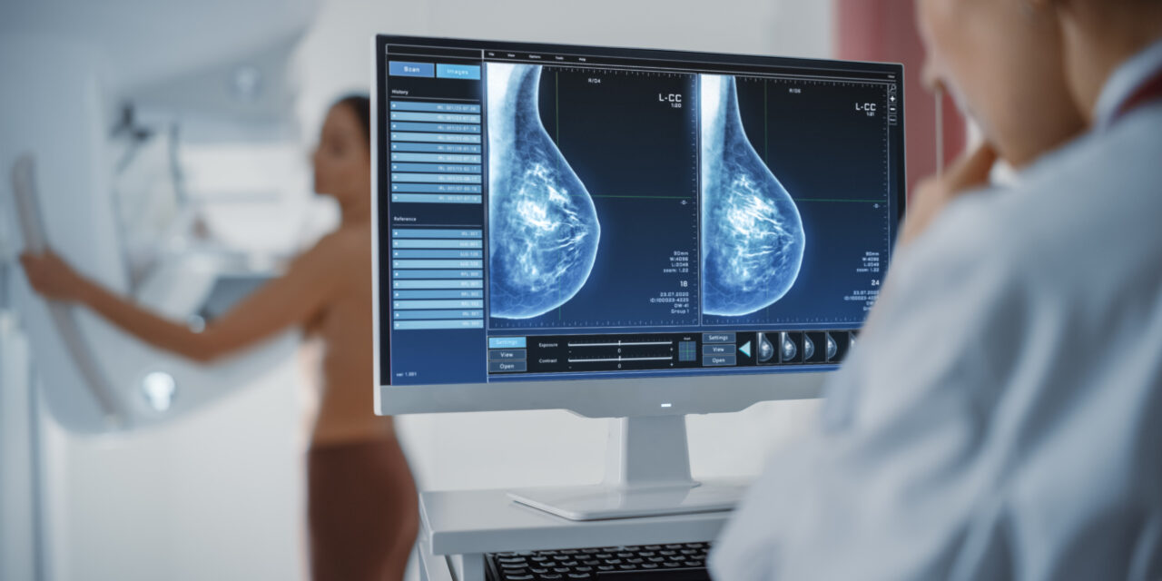 What You Need to Know About Breast Density