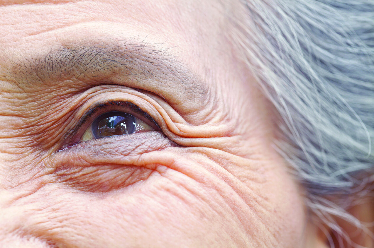 June is Cataract Awareness Month!